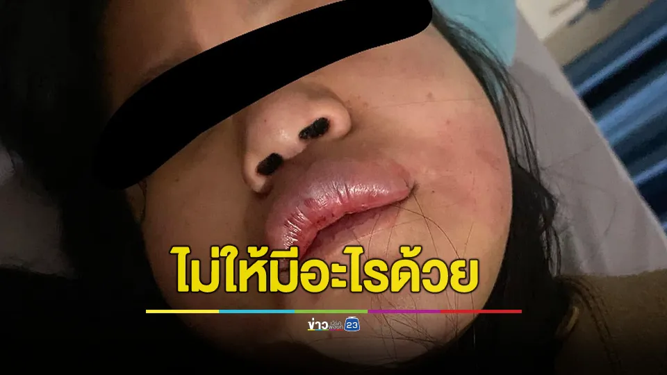 ซ้อมสลบหลังถูกปฏิเสธมีเพศสัมพันธ์