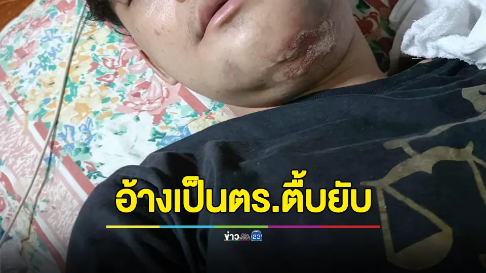 แม่ร้องลูกถูกชายอ้างเป็นตำรวจตื้บยับ