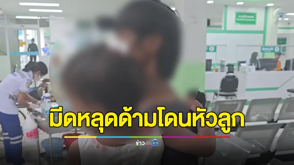 พ่อใจหาย! เอาอีโต้ฟันไม้มีดหลุด ด้ามโดนหัวลูกขวบเศษถึงกะโหลก