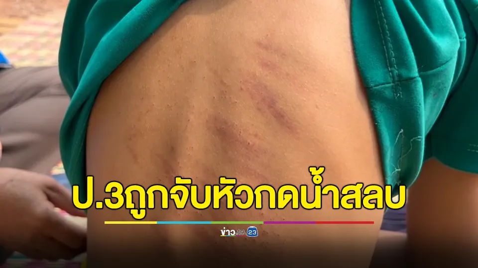 สะเทือนใจ! 4 ต่อ 1 รุม ถูกเพื่อน ป.3 รุมทำร้าย หลังไม่พอใจที่สั่งให้ไปเอาข้าวมาให้กิน แล้วไม่ไป โดนลากเข้าห้องน้ำ จับกดน้ำจนสลบ เอาแปรงขัดห้องน้ำตีหลังลาย 