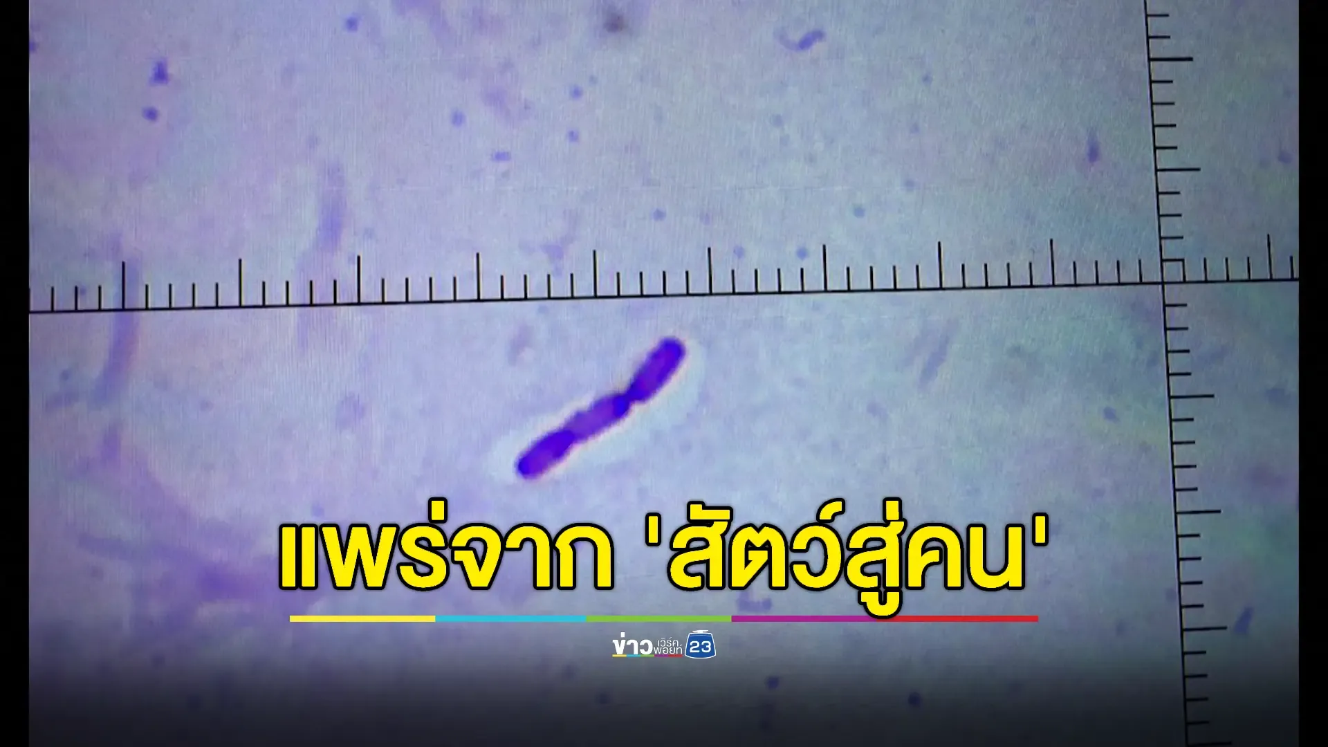 รัฐบาล ย้ำ "โรคแอนแทรกซ์" ไม่ติดต่อจากคนสู่คน 