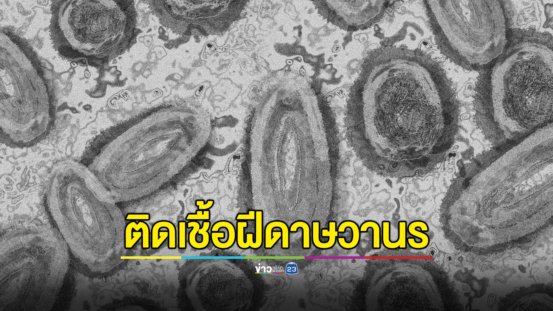 จับตา!"ฝีดาษวานร"พบป่วยแล้ว 4 ราย เตือนกลุ่มเสี่ยง