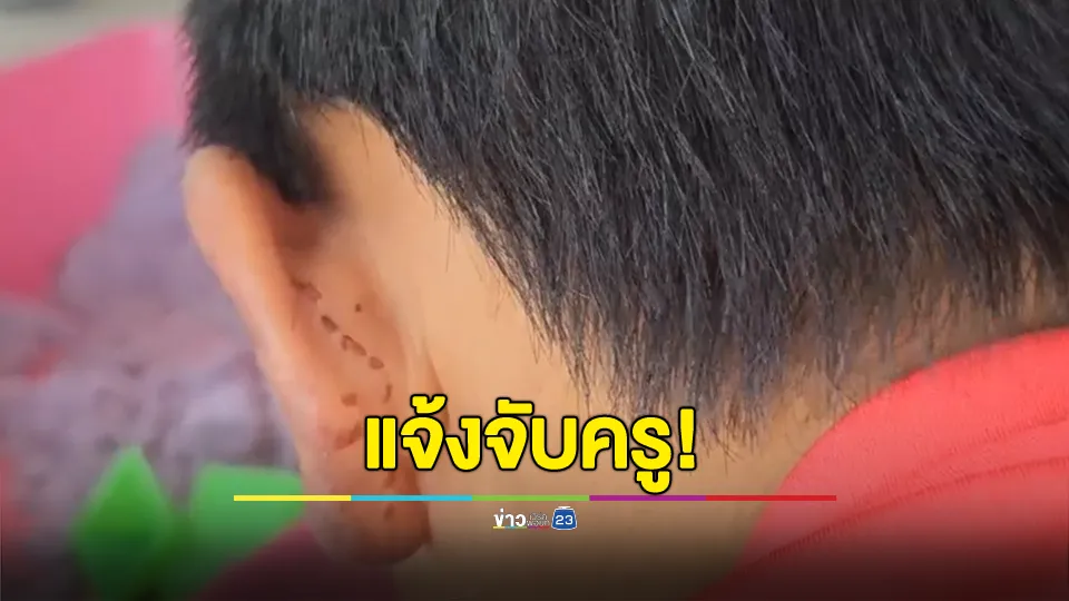 หัวอกแม่! โพสต์ลูกชาย ป.3 ถูกครูทำโทษ ให้เพื่อนผลัดกันหยิกหู จนเขียวช้ำอักเสบ