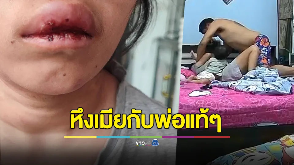 ร้องถูกผัวดื่มน้ำกระท่อม ผสมยาแก้ไอ ตื้บน่วม หลอนหึงหวงเมียคิดว่ามีอะไรกับพ่อแท้ๆ