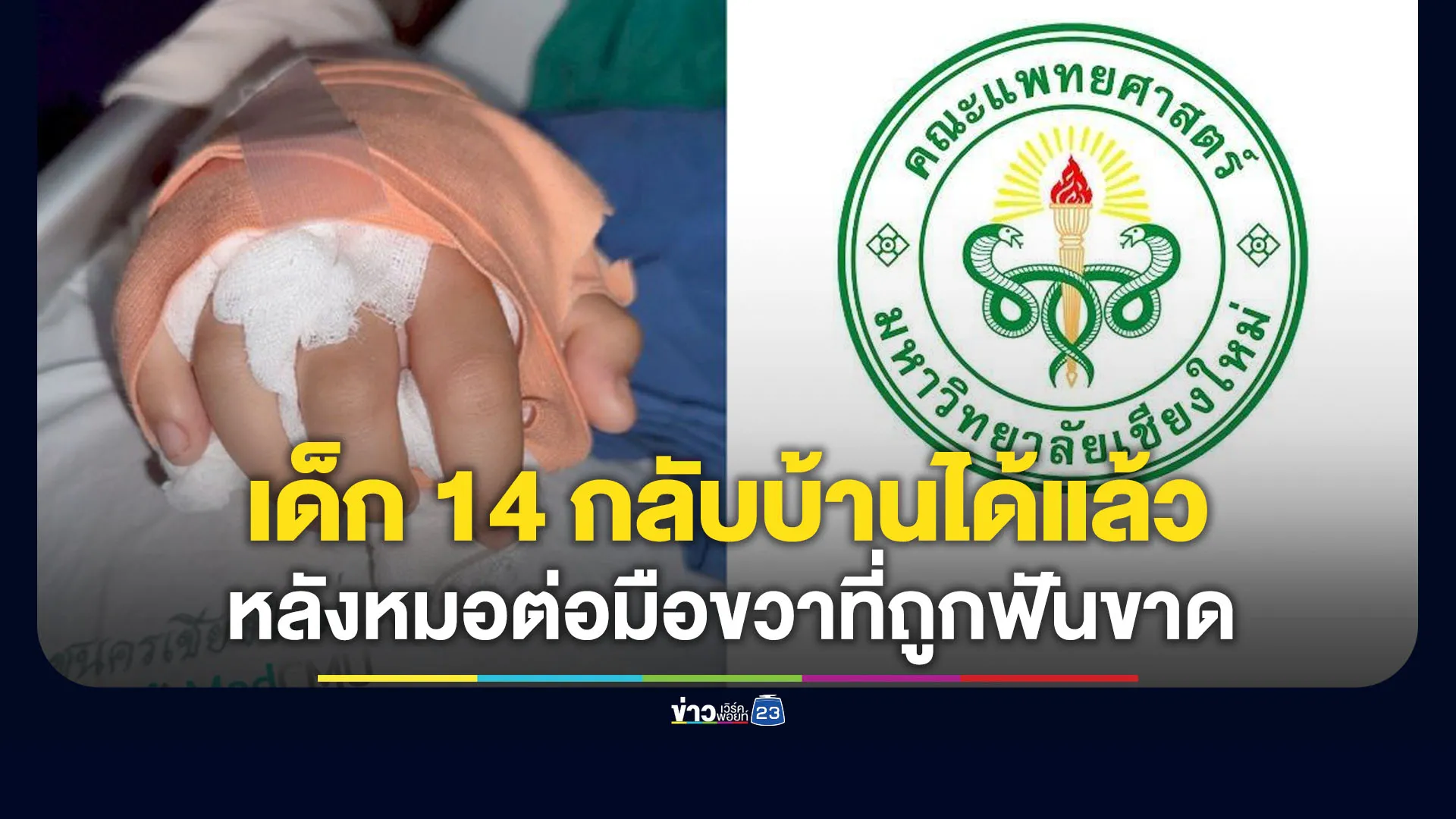 เด็ก 14 ข้อมือขาดกลับบ้านได้แล้ว หลังรักษาต่อมือ 24 วัน