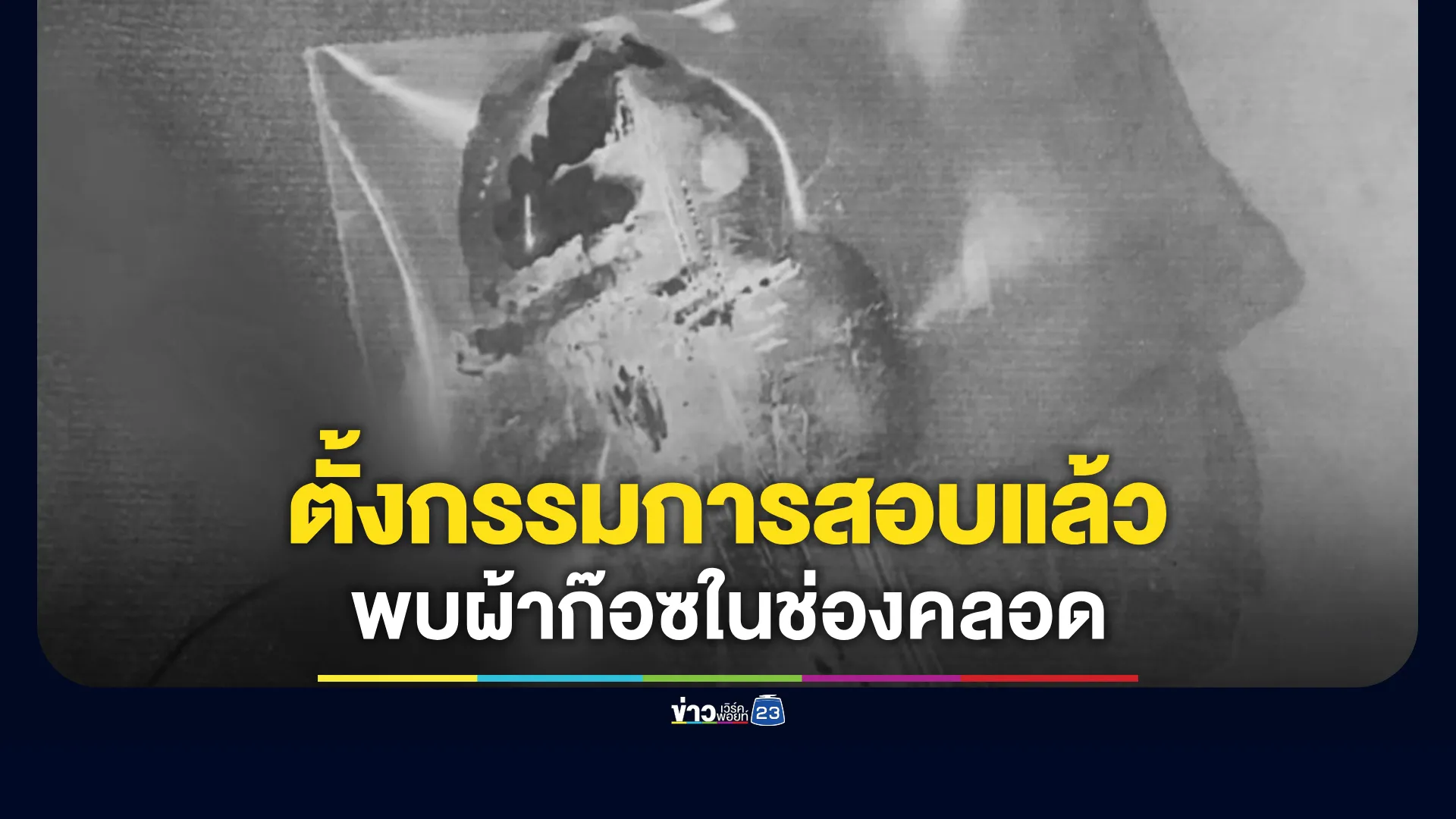 ผอ.รพ.แจง ตั้งกรรมการสอบแล้วหลังเกิดเรื่อง พบผ้าก๊อซในช่องคลอด