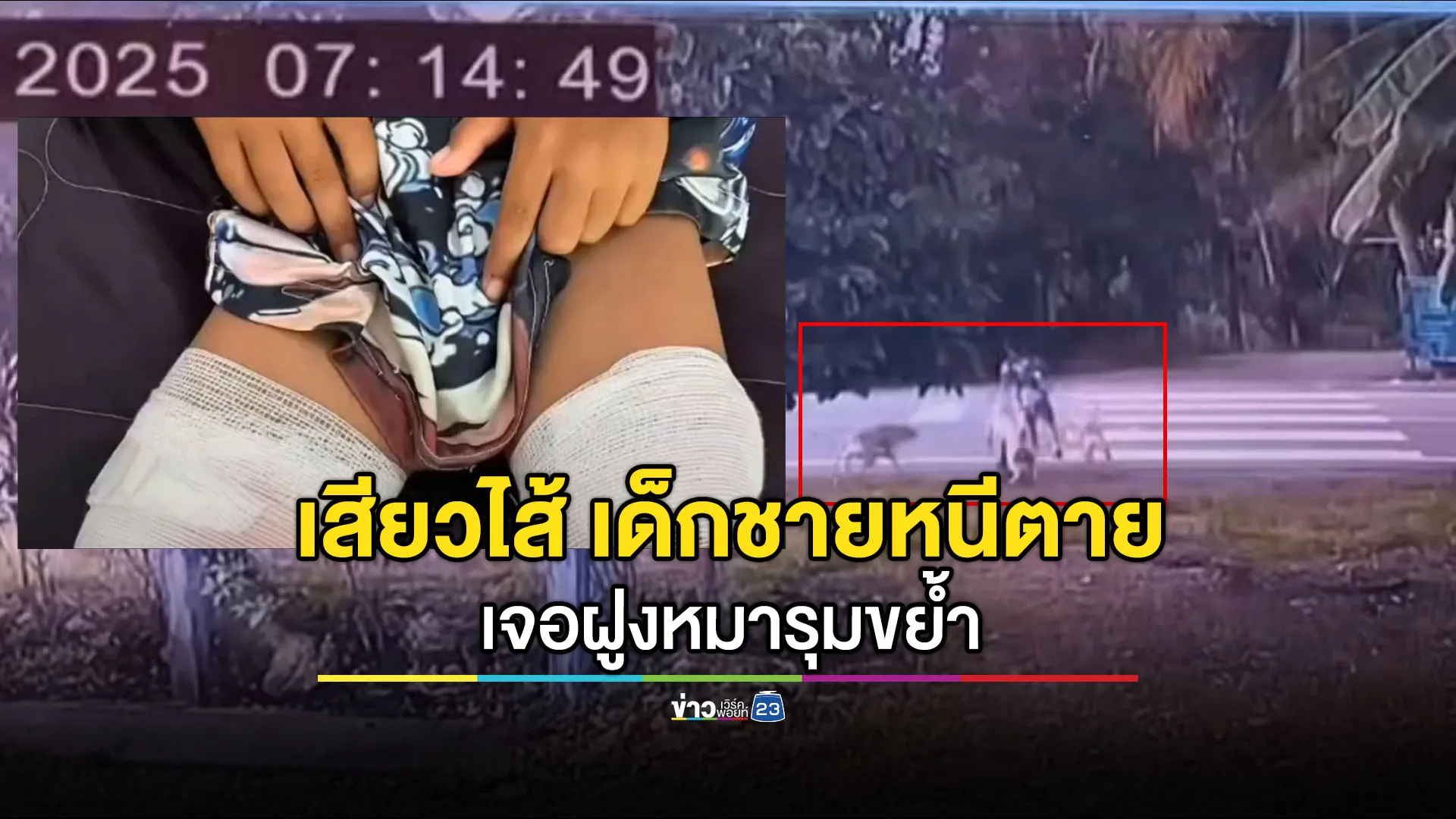 เด็กชายหนีตายถูกฝูงหมารุมขย้ำ โชคดีไม่มีรถชนซ้ำ