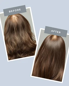 Before and after scalp care creative.