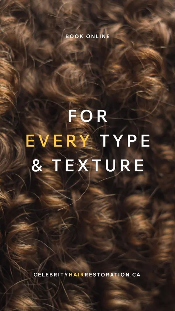 Celebrity Hair Restoration Instagram story creative example (4 of 4)
