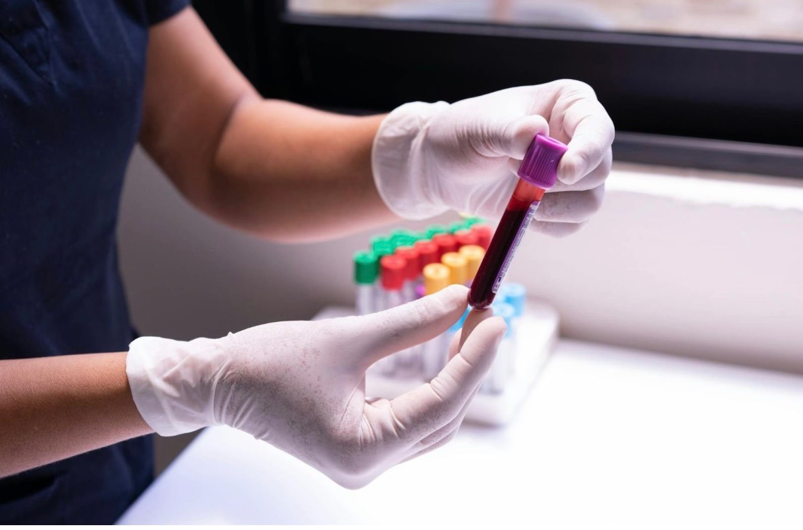 Understanding Human Blood Types: The Key to Personalized Nutrition and Preventive Healthcare