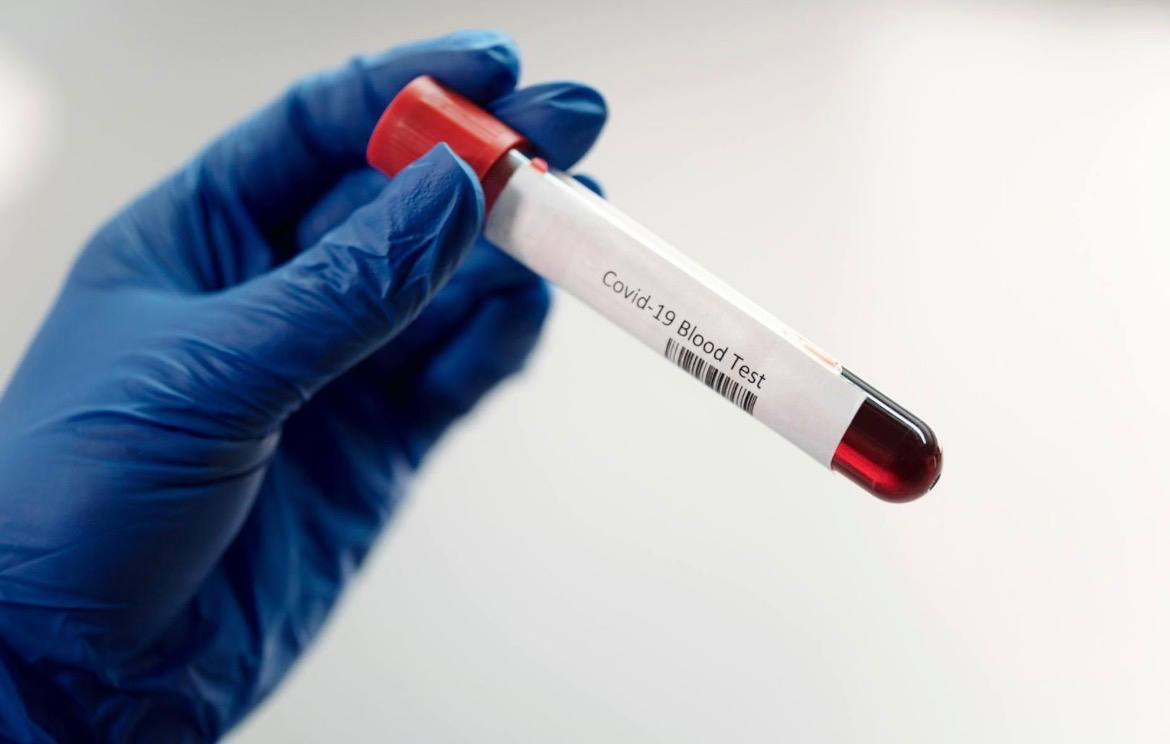 Do You Know Your Ferritin Levels? How Iron Deficiency is Misdiagnosed? How ZataData®️ Is Driving Change in Healthcare