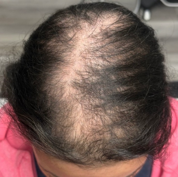 Unraveling the Root Causes of Hair Loss: Why It’s More Than Skin Deep