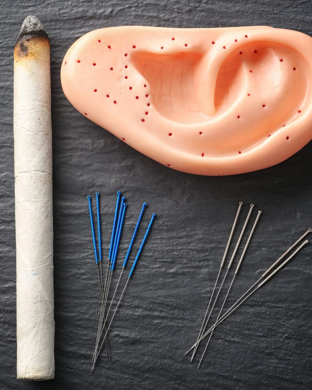 Unlocking the Healing Power of Acupuncture: Benefits for Mind and Body