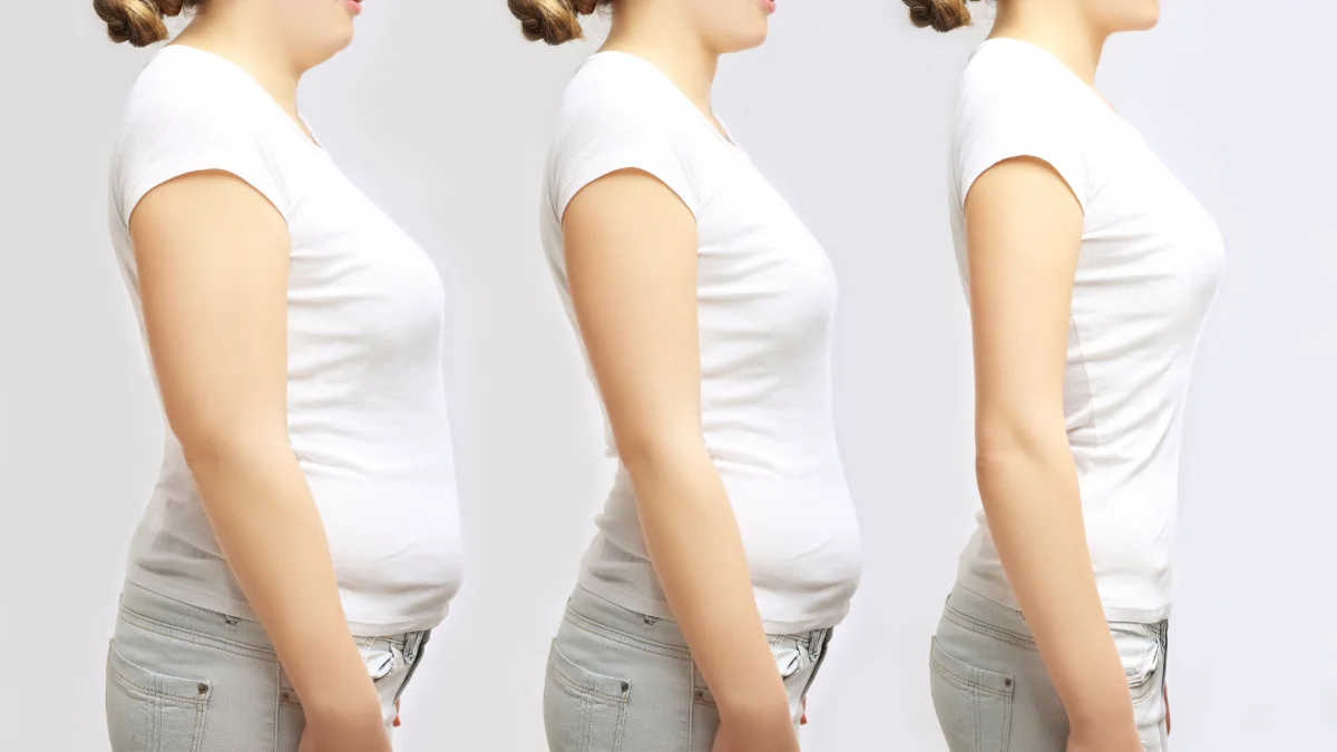 Beyond the Scale: Supporting Sustainable Weight Loss in the Age of GLP-1s and Bariatric Surgery