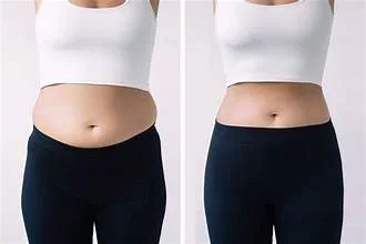 Body Contouring: Shaping Confidence When Diet & Exercise Aren’t Enough