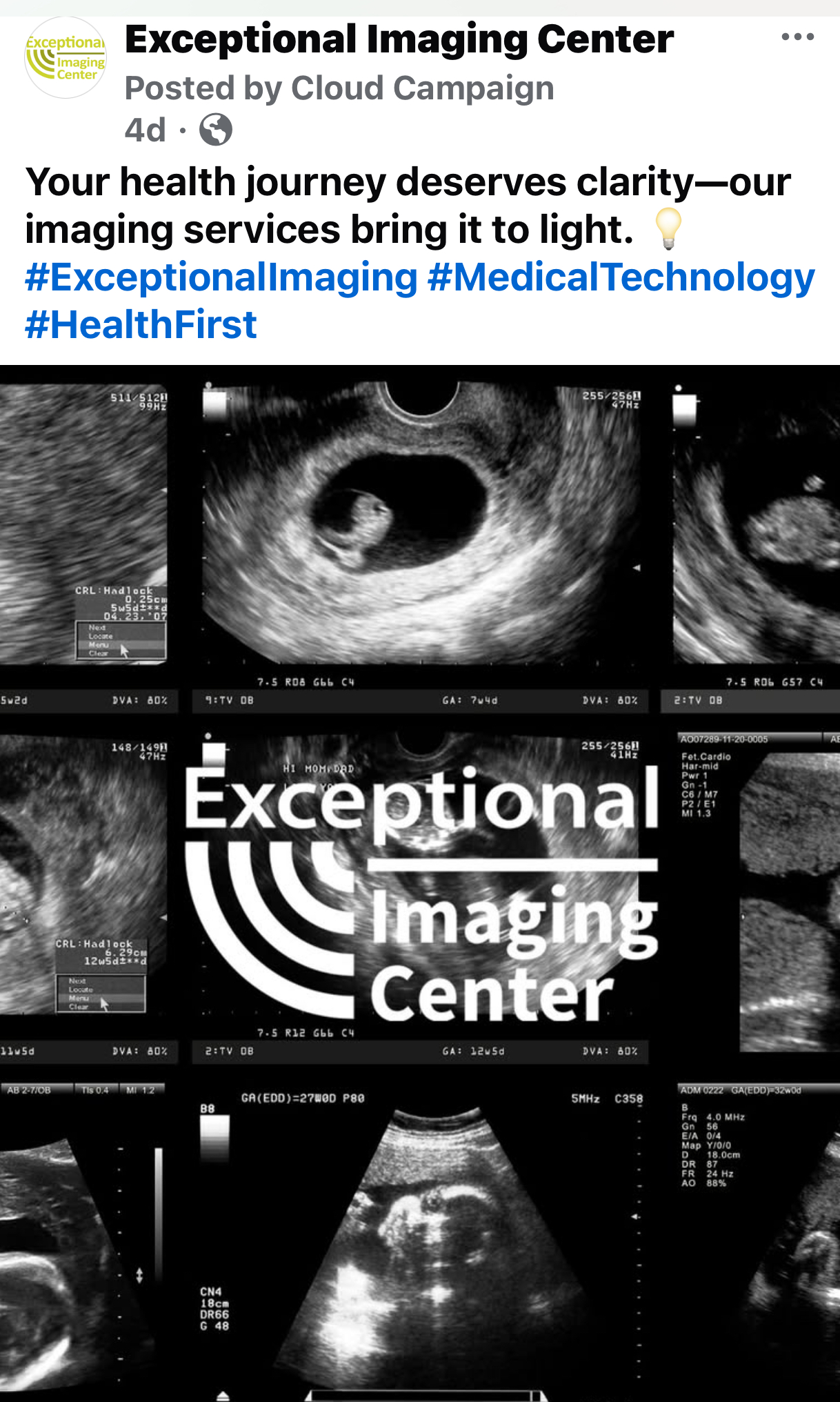 Exceptional Imaging Center