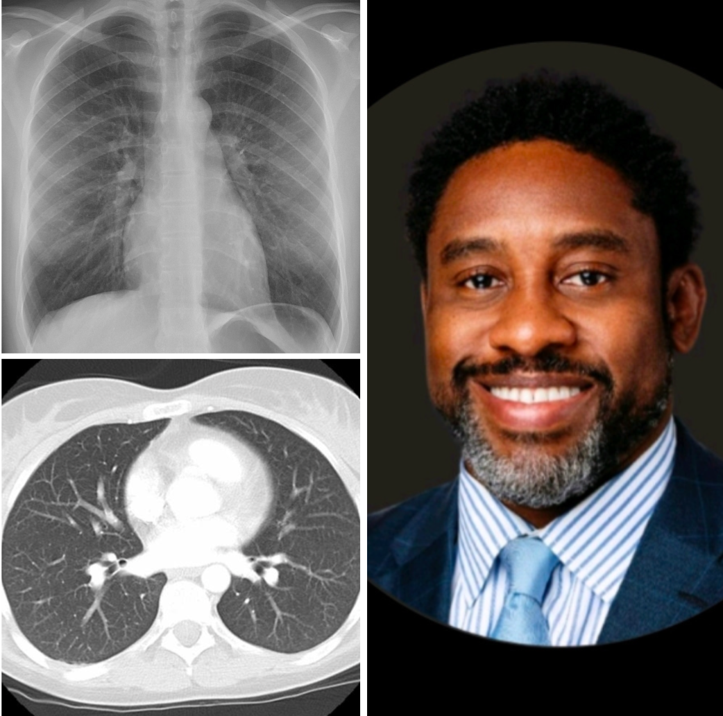 Thoracic And Emergency Teleradiology, Pc