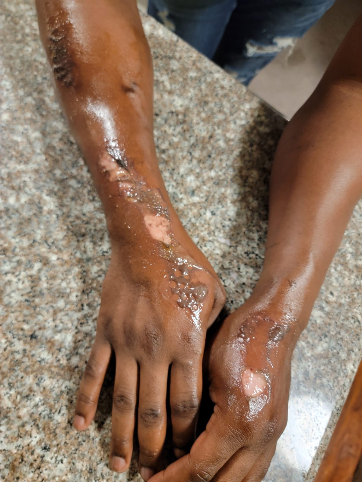 Steers Enterprise Ll/bls/cpr &aed Certification