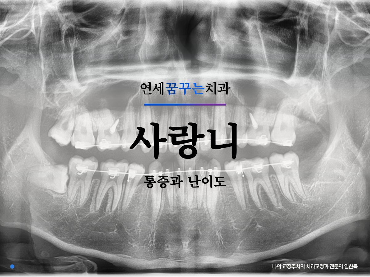 통증과 난이도가 다른 이유 (매복 종류별 총정리) 대표 이미지