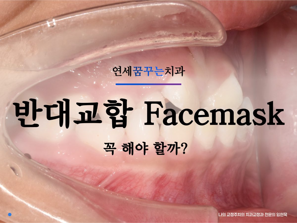 앞니 반대교합, 턱교정(페이스마스크) 꼭 해야 할까요? 시기와 장치 선택 A to Z 대표 이미지