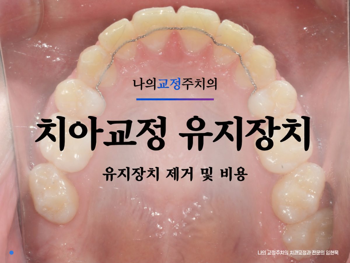 고정식 유지장치 제거 비용·가철식 유지장치 가격｜연세꿈꾸는치과 대표 이미지