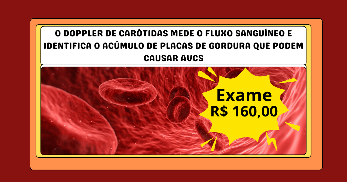 Doppler de Carótidas - ecodoppler - R$ 160,00 ⚕️